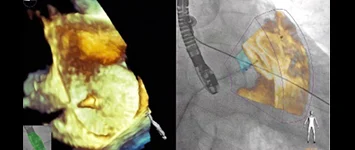 3D ECHO 360° – Full Scientific Program (ALL COURSES-Basic and Advanced) 3D ECHO 360° – Full Scientific Program (ALL COURSES-Basic and Advanced)