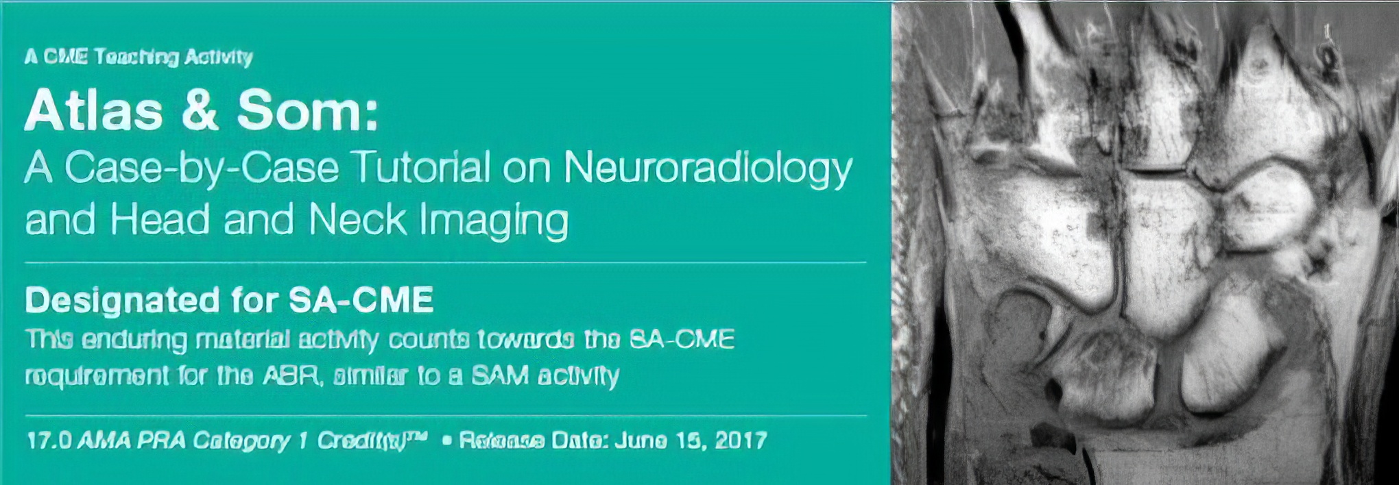 Atlas & Som: A Case-by-Case Tutorial On Neuroradiology and Head and Neck Imaging 2017 Atlas & Som: A Case-by-Case Tutorial On Neuroradiology and Head and Neck Imaging 2017