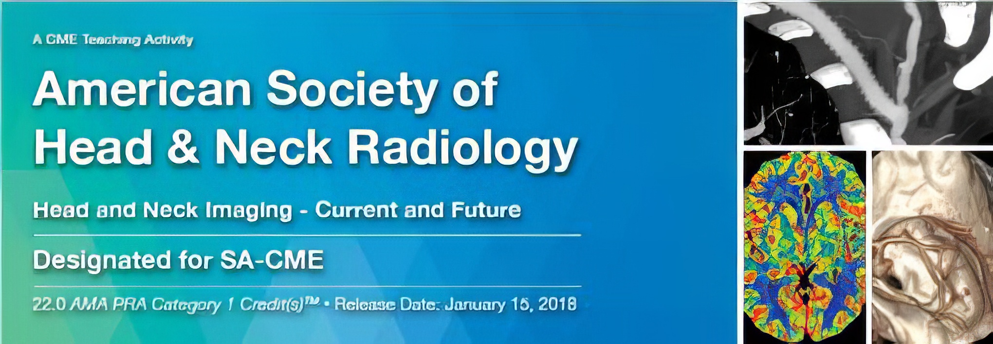 2018 American Society of Head and Neck Radiology ( VIDEOS) 2018 American Society of Head and Neck Radiology