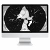 ARRS Basic Chest Imaging 2019