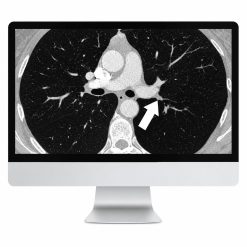 ARRS Basic Chest Imaging 2019