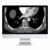 Clinical Cardiopulmonary Imaging Review 2019 (ARRS VIDEOS) Clinical Cardiopulmonary Imaging Review 2019 (ARRS VIDEOS)