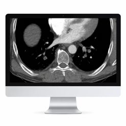 Clinical Cardiopulmonary Imaging Review 2019 (ARRS VIDEOS)
