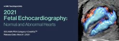Fetal Echocardiography: Normal and Abnormal Hearts 2021