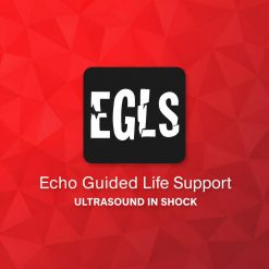 ECHO-Guided Life Support Using ultrasound to categorise shock and guide initial management