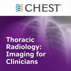 Thoracic Radiology: Imaging for Clinicians (Chestnet) 2021 (Videos + Quiz)