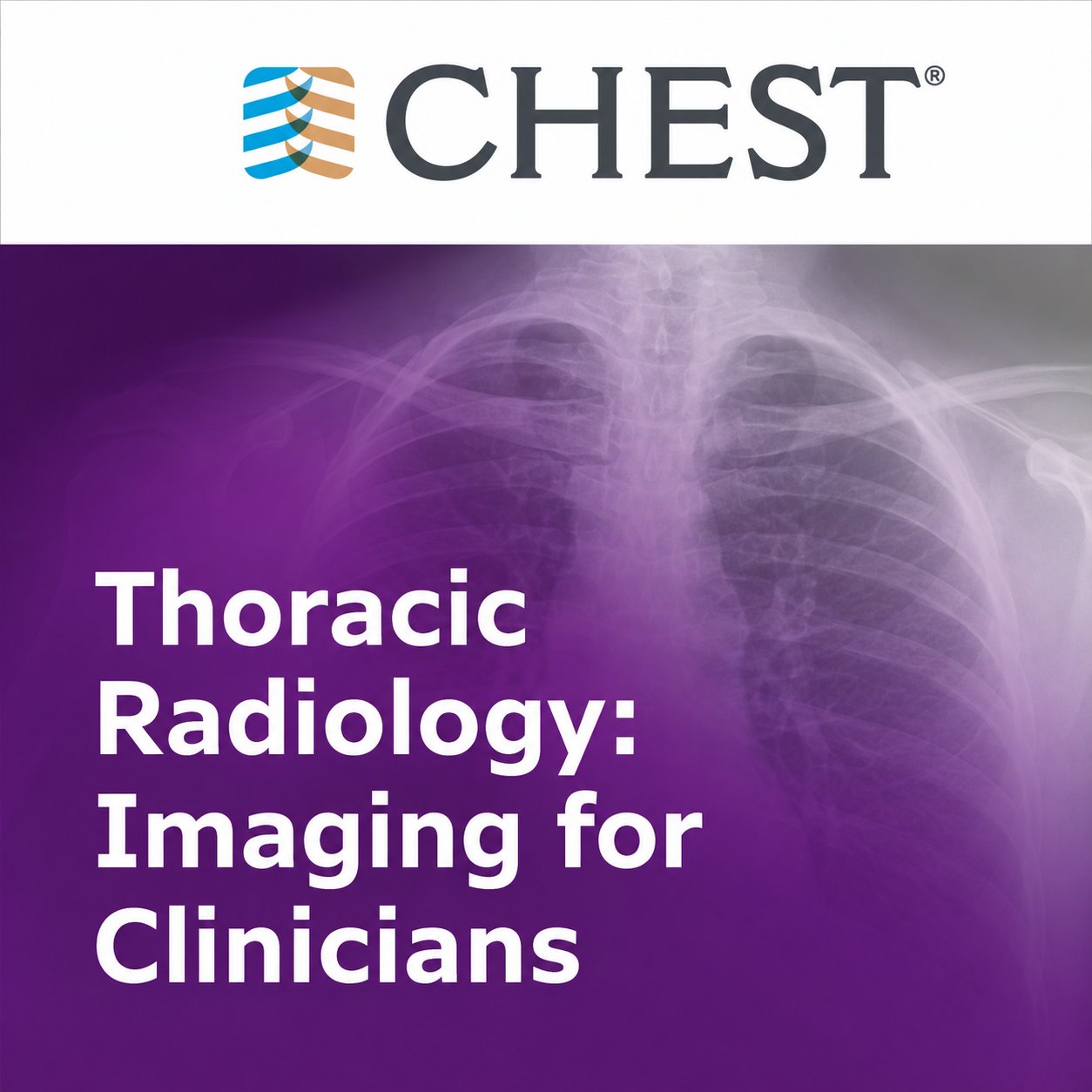 Thoracic Radiology: Imaging for Clinicians (Chestnet) 2021 (Videos + Quiz) Thoracic Radiology: Imaging for Clinicians (Chestnet) 2021 (Videos + Quiz)