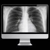 ARRS Case-Based Imaging Review Online Course 2022