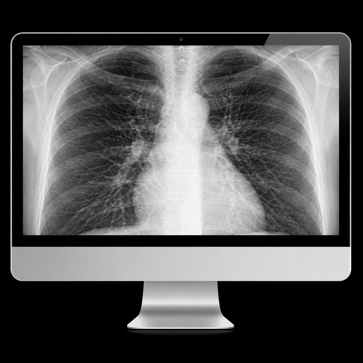ARRS Case-Based Imaging Review Online Course 2022 ARRS Case-Based Imaging Review Online Course 2022
