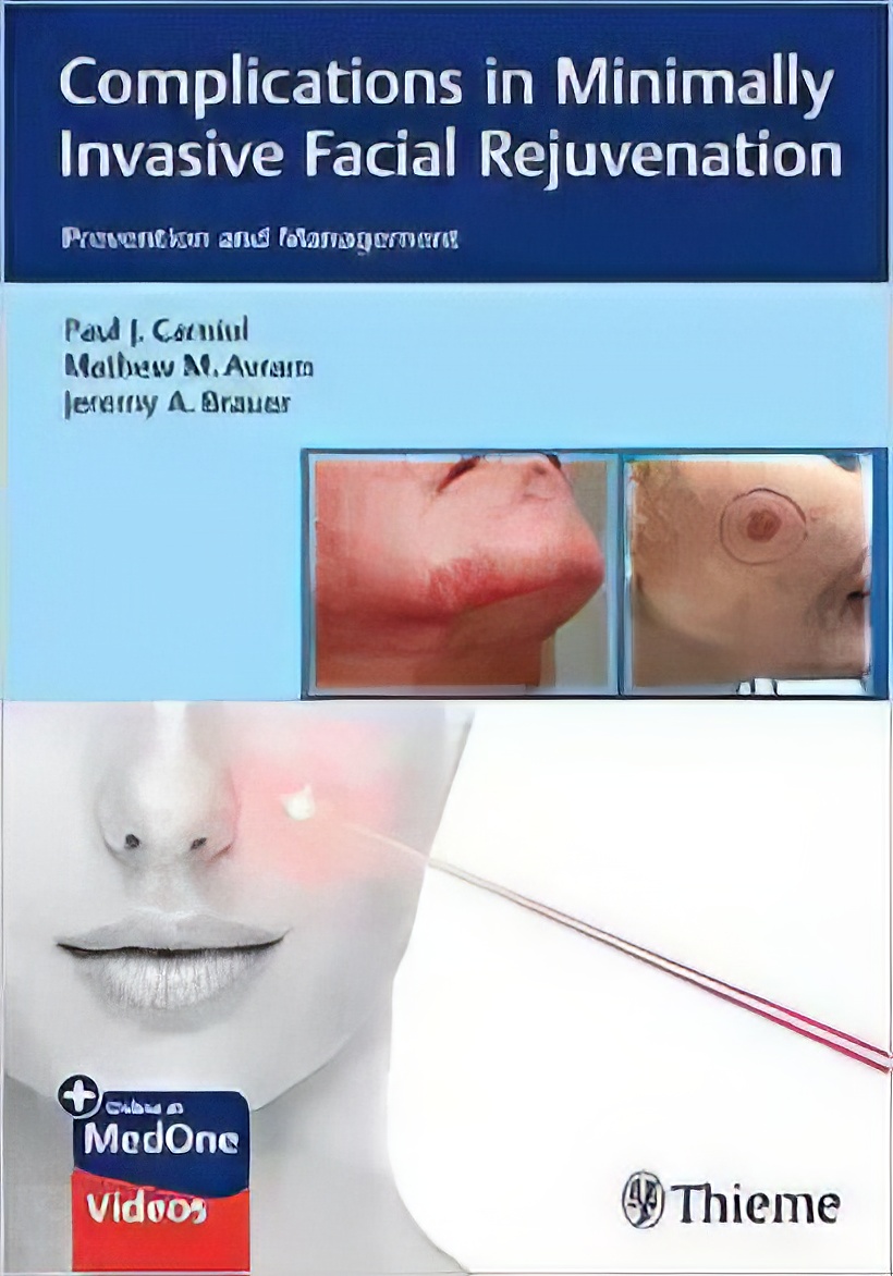 Complications In Minimally Invasive Facial Rejuvenation: Prevention And Management (EPUB and pdf) Complications In Minimally Invasive Facial Rejuvenation: Prevention And Management (EPUB)