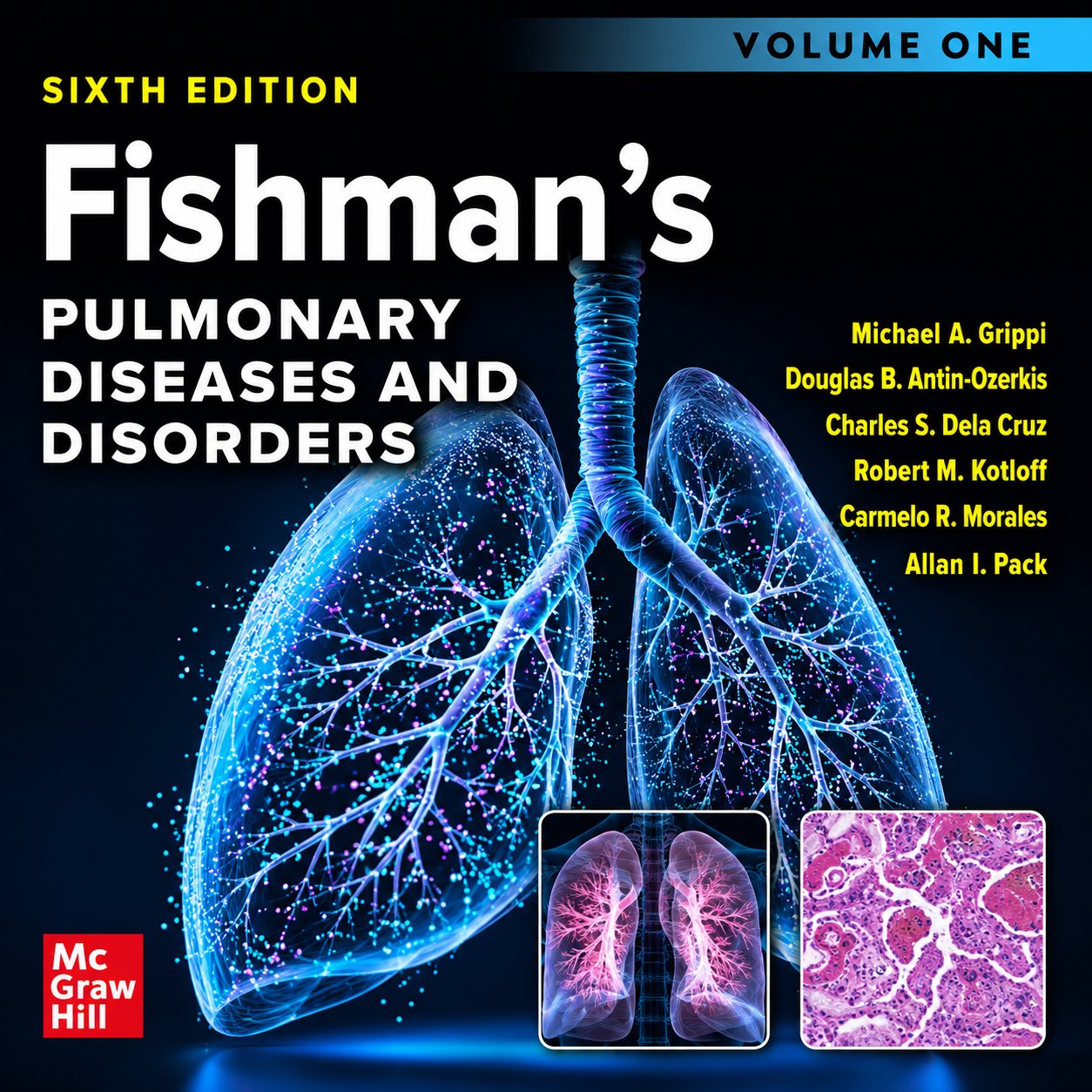 Fishman’s Pulmonary Diseases and Disorders, 2-Volume Set, Sixth Edition (Original PDF from Publisher) Fishman’s Pulmonary Diseases and Disorders, 2-Volume Set, Sixth Edition (Original PDF from Publisher)