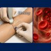 Pegasus Fundamentals Of Phlebology Ultrasound And Venous Insufficiency 2022 Pegasus Fundamentals Of Phlebology Ultrasound And Venous Insufficiency 2022