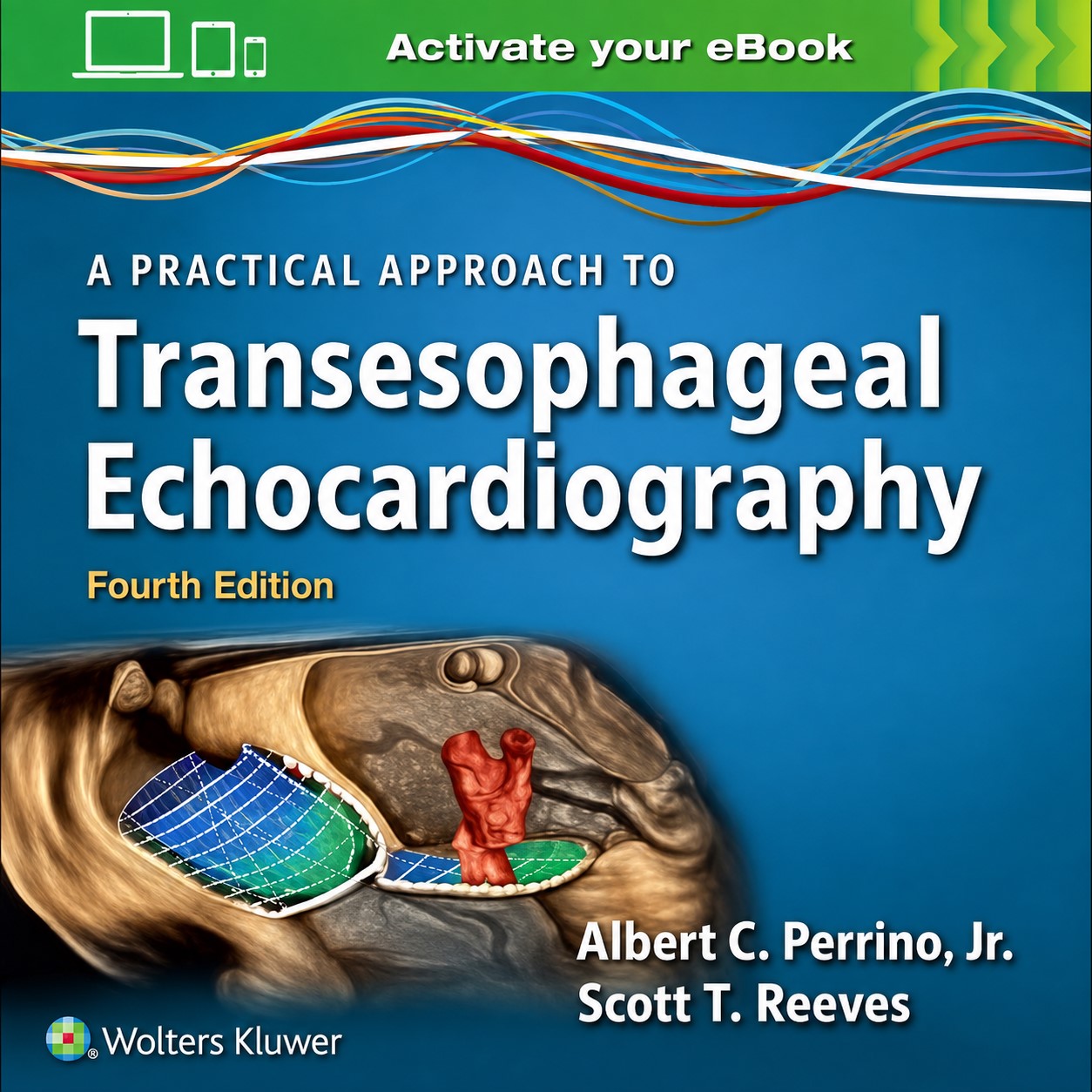 A Practical Approach to Transesophageal Echocardiography, 4th Edition (Videos only) A Practical Approach to Transesophageal Echocardiography, 4th Edition (Videos only)
