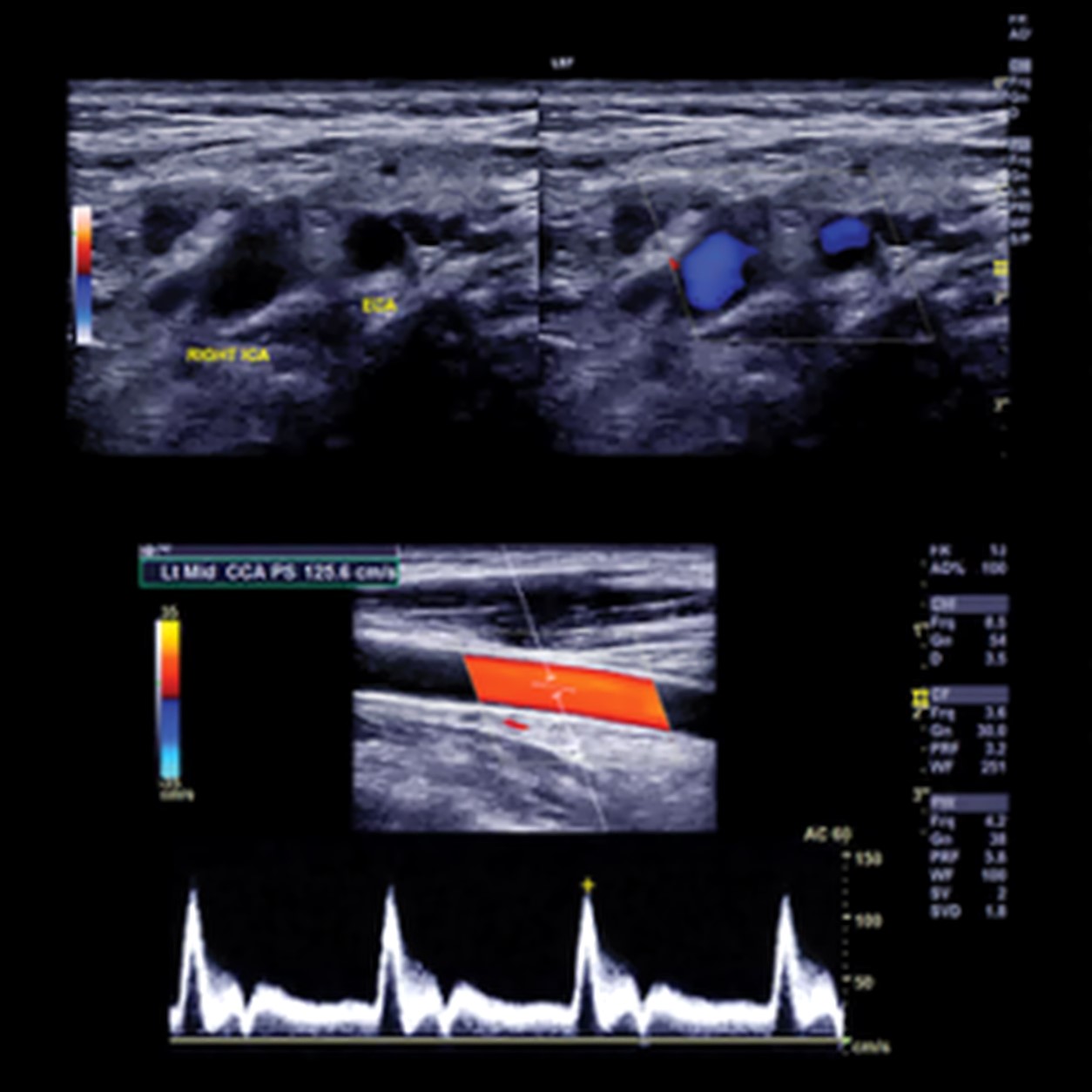 Clinical Approach to Vascular Ultrasound and RPVI Prep Course 2023 Clinical Approach to Vascular Ultrasound and RPVI Prep Course 2023