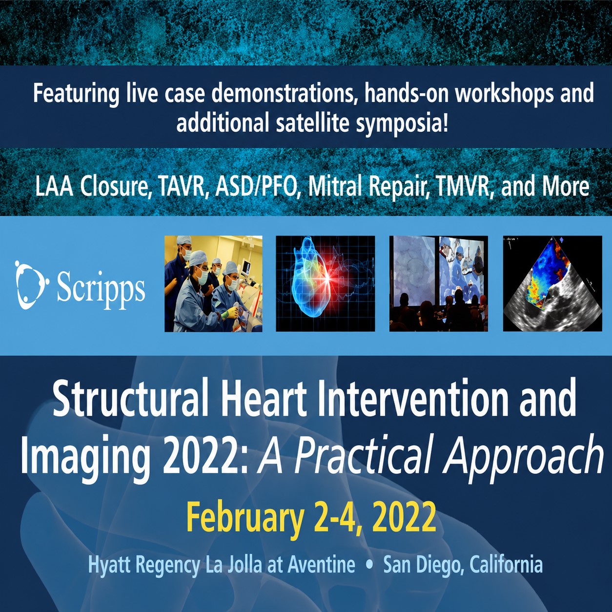Scripps 11th Annual Structural Heart Intervention and Imaging 2022 Scripps 11th Annual Structural Heart Intervention and Imaging 2022
