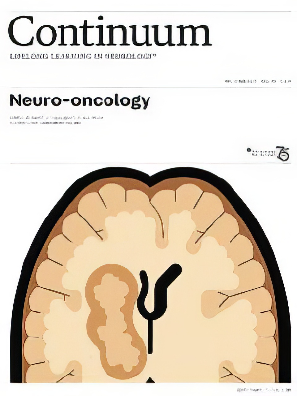 CONTINUUM Lifelong Learning in Neurology (Neuro-oncology) December 2023, Vol.29, No.6 (TRUE PDF) CONTINUUM Lifelong Learning in Neurology (Neuro-oncology) December 2023, Vol.29, No.6 (TRUE PDF)