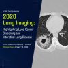 ARRS Lung Cancer Screening A Comprehensive Guide Online Course