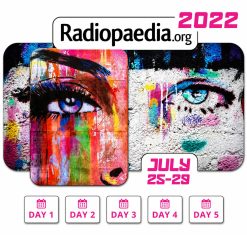 Radiopedia 2022 – Virtual Conference (Videos)