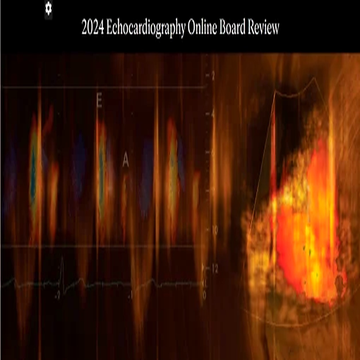Mayo Clinic 2024 Echocardiography Online Board Review (Videos + Slides) Mayo Clinic 2024 Echocardiography Online Board Review (Videos + Slides)