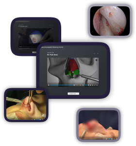 Perface Rhinoplasty Encyclopedia – SV – Mastering The Art Perface Rhinoplasty Encyclopedia – SV – Mastering The Art