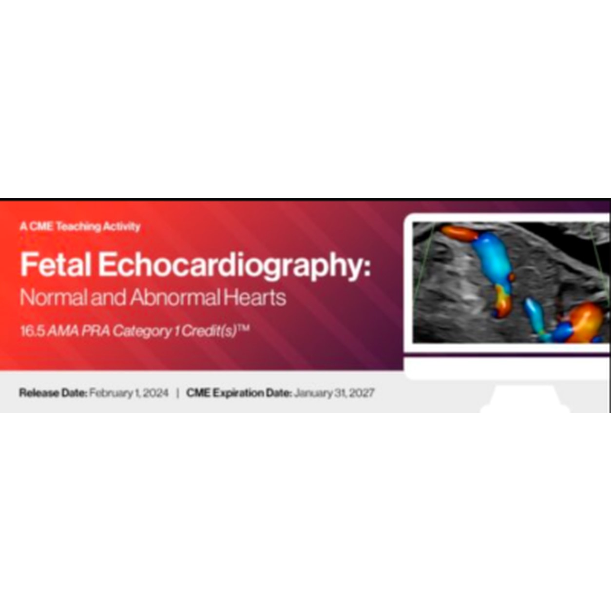 2024 Fetal Echocardiography: Normal and Abnormal Hearts – A Video CME Teaching Activity 2024 Fetal Echocardiography: Normal and Abnormal Hearts – A Video CME Teaching Activity