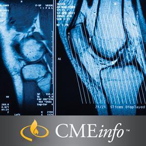 UCSF Musculoskeletal MRI 2018 0001835 ucsf musculoskeletal mri 300