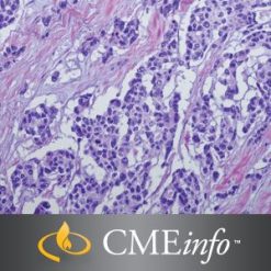 0001848 soft tissue tumors 300