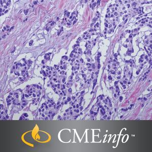 Soft Tissue Tumors – Masters of Pathology Series 2018 0001848 soft tissue tumors 300