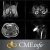 UCSF Abdominal and Thoracic Imaging 2019 ( Videos) 0002046 ucsf abdominal and thoracic imaging