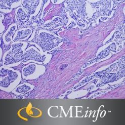 0002067 pancreatic pathology 300