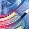 1639037647 213048117 comprehensive review and update of what rsquo s new in vascular and endovascular surgery 2021 510x284 1