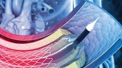 1639037647 213048117 comprehensive review and update of what rsquo s new in vascular and endovascular surgery 2021 510x284 1
