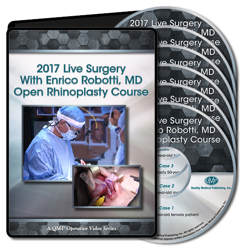 2017 Live Surgery With Enrico Robotti Open Rhinoplasty Course 2017 Live Surgery With Enrico Robotti Open Rhinoplasty Course