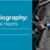 2018 Fetal Echocardiography Normal and Abnormal Hearts CME Videos