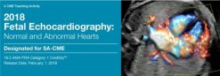2018 Fetal Echocardiography Normal and Abnormal Hearts CME Videos