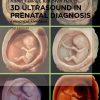 3D Ultrasound in prenatal diagnosis by Rabih Chaoui 2nd edition original PDF 2024 3D Ultrasound in prenatal diagnosis by Rabih Chaoui 2nd edition original PDF 2024
