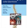 The ASSI Monographs: Lumbar Spinal Stenosis (Original PDF from Publisher) The ASSI Monographs-Lumbar Spinal Stenosis