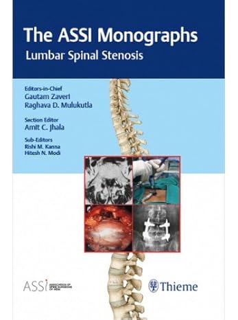 The ASSI Monographs: Lumbar Spinal Stenosis (Original PDF from Publisher) The ASSI Monographs-Lumbar Spinal Stenosis