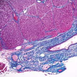 531 current topics in gastrointestinal and liver pathology cme  25052 2