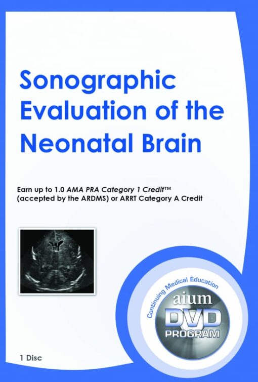 AIUM Sonographic Evaluation of the Neonatal Brain 60326 550x814 510x755 1
