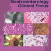 Gastroenterology Clinical Focus: High yield GI and hepatology review- for Boards and Practice – 3rd edition (Original PDF from Publisher) 8797062349
