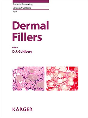 Dermal Fillers (Aesthetic Dermatology, Vol. 4) (PDF) Dermal Fillers (Aesthetic Dermatology, Vol. 4) (PDF)