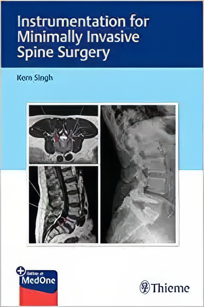 Instrumentation for Minimally Invasive Spine Surgery (EPUB and pdf) Instrumentation for Minimally Invasive Spine Surgery (EPUB)