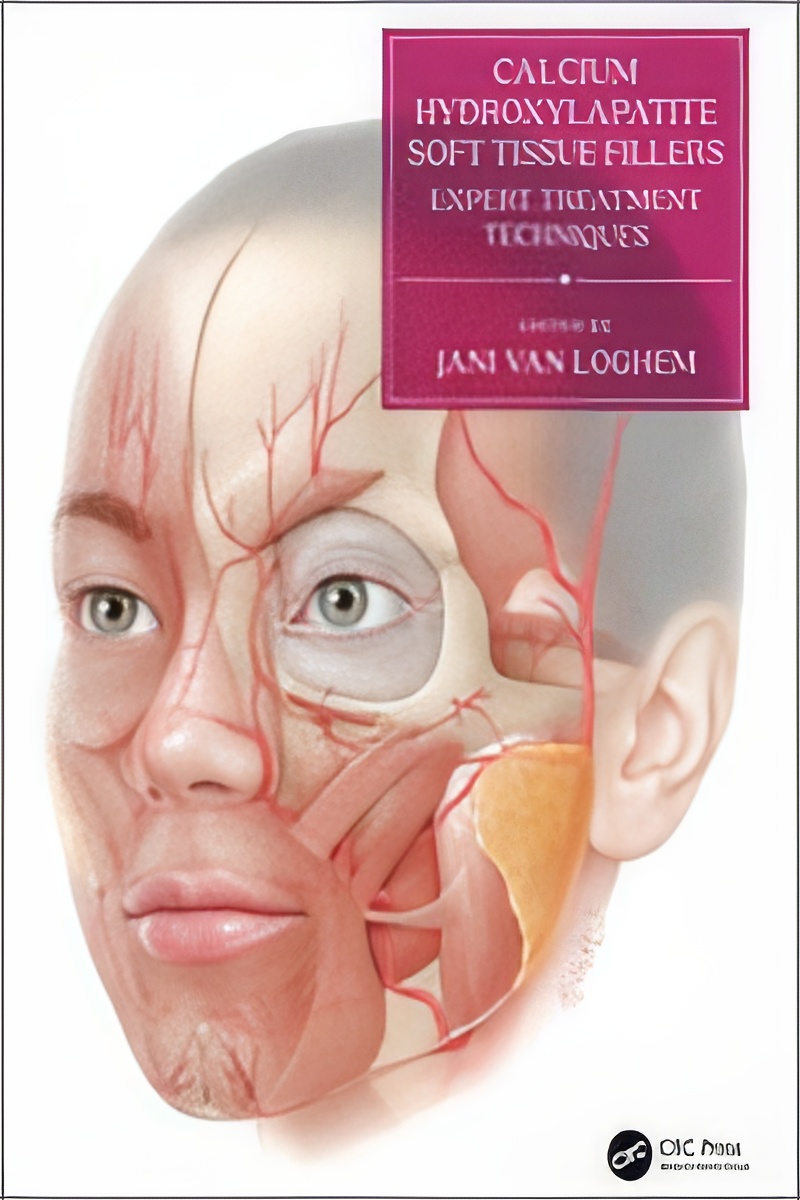 Calcium Hydroxylapatite Soft Tissue Fillers (Book & Videos) Calcium Hydroxylapatite: Expert Treatment Techniques is a hands-on reference book, created with the input of the world’s leading experts on the use of this leading biostimulatory soft tissue filler.