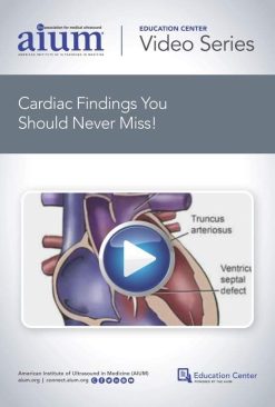 AIUM Cardiac Findings You Should Never Miss