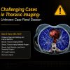 ARRS Challenging Cases in Thoracic Imaging 2024 ARRS Challenging Cases in Thoracic Imaging 2024