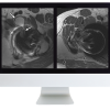 ARRS Controversies In Hip And Pelvis Imaging 2016 ARRS Controversies In Hip And Pelvis Imaging 2016 (CME VIDEOS)
