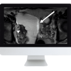 ARRS Pitfalls in GI Imaging 2022