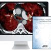 ARRS Practical Dual Energy CT Throughout the Body 2021 CME VIDEOS