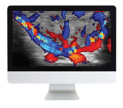 ARRS Thyroid Imaging 2019 ( VIDEOS)